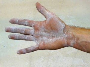 Magnesium oil residue on a man's hand. 